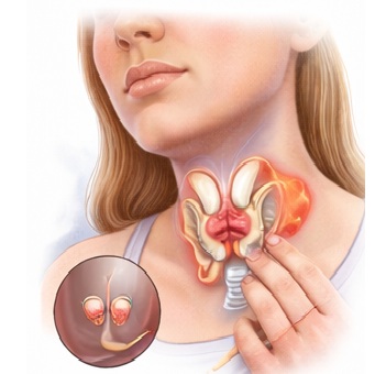 Thyroid Health